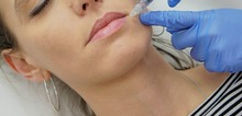 Small2_skinpal1