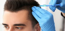 Small2_prp_treatment
